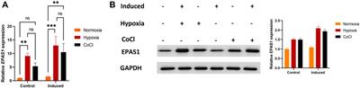 Regulation of erythroid differentiation in K562 cells by the EPAS1-IRS2 axis under hypoxic conditions